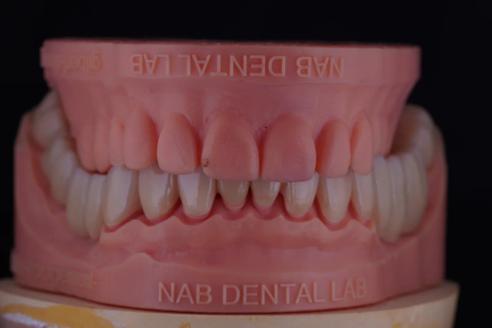 Zirconia Bridge — 16 Units photo 2