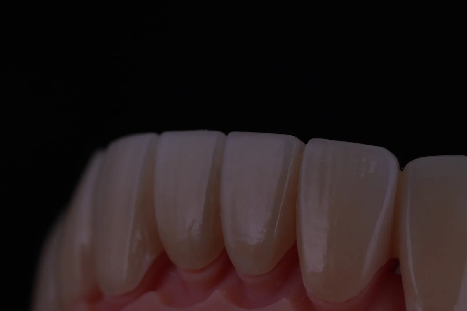 Zirconia Bridge — 16 Units photo 5