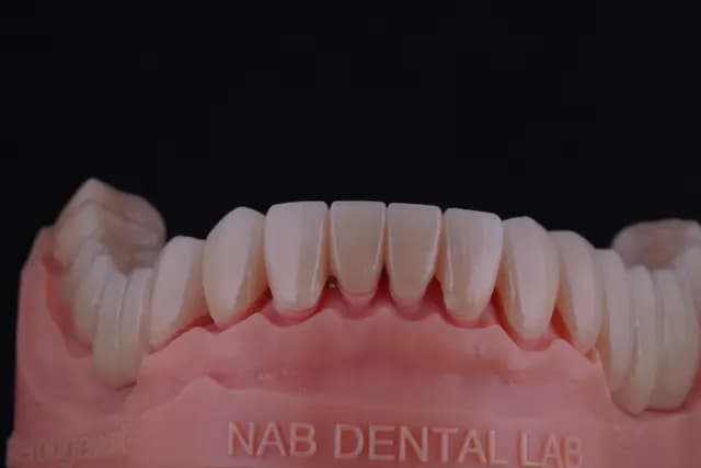 Zirconia Bridge — 16 Units