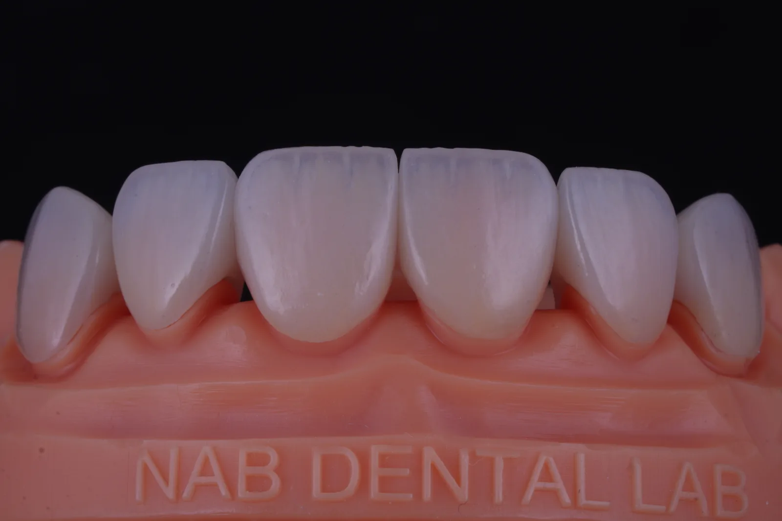 Emax Crown — Natural photo 4