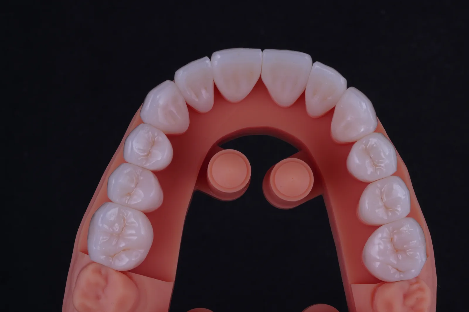 Zirconia Crown — Classic photo 2