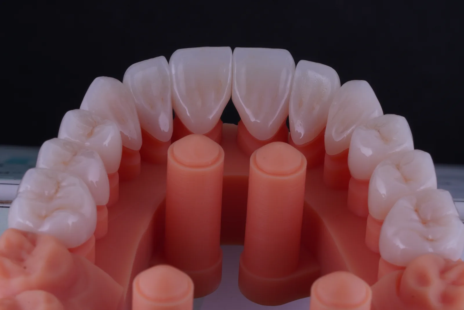 Zirconia Crown — Classic photo 3