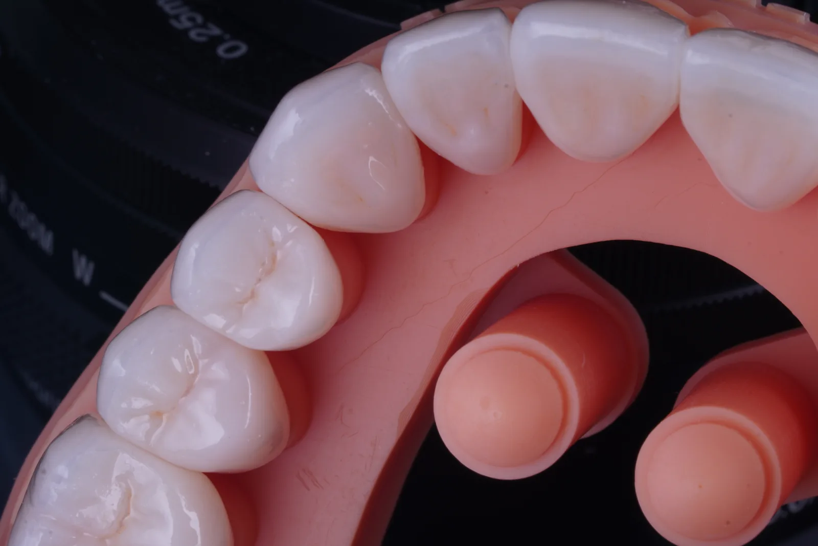 Zirconia Crown — Classic photo 6