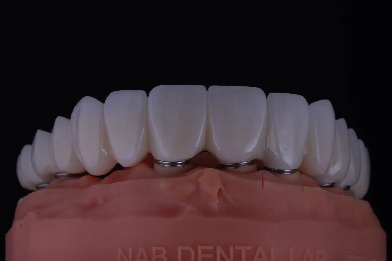All-on-X — Full-Arch Reconstruction photo 7