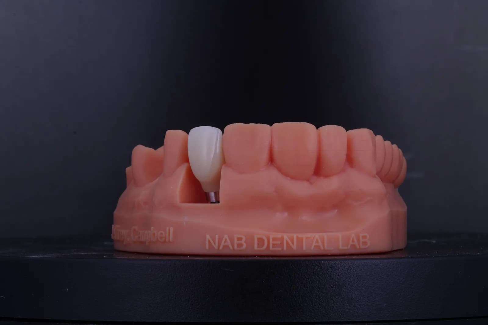 Implant Crown — Lateral photo 1