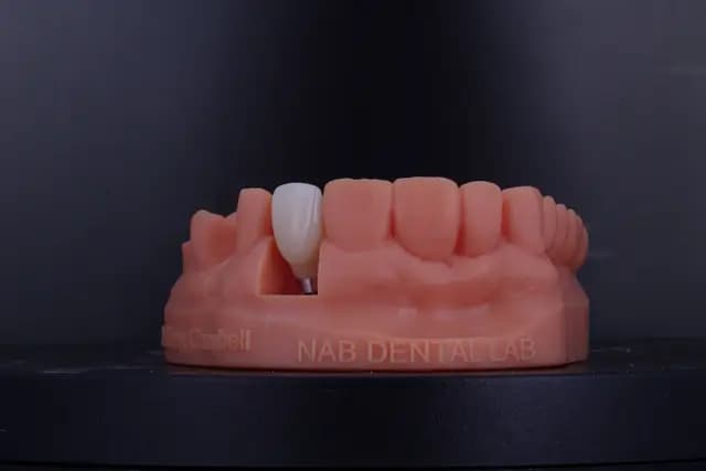 Implant Crown — Lateral