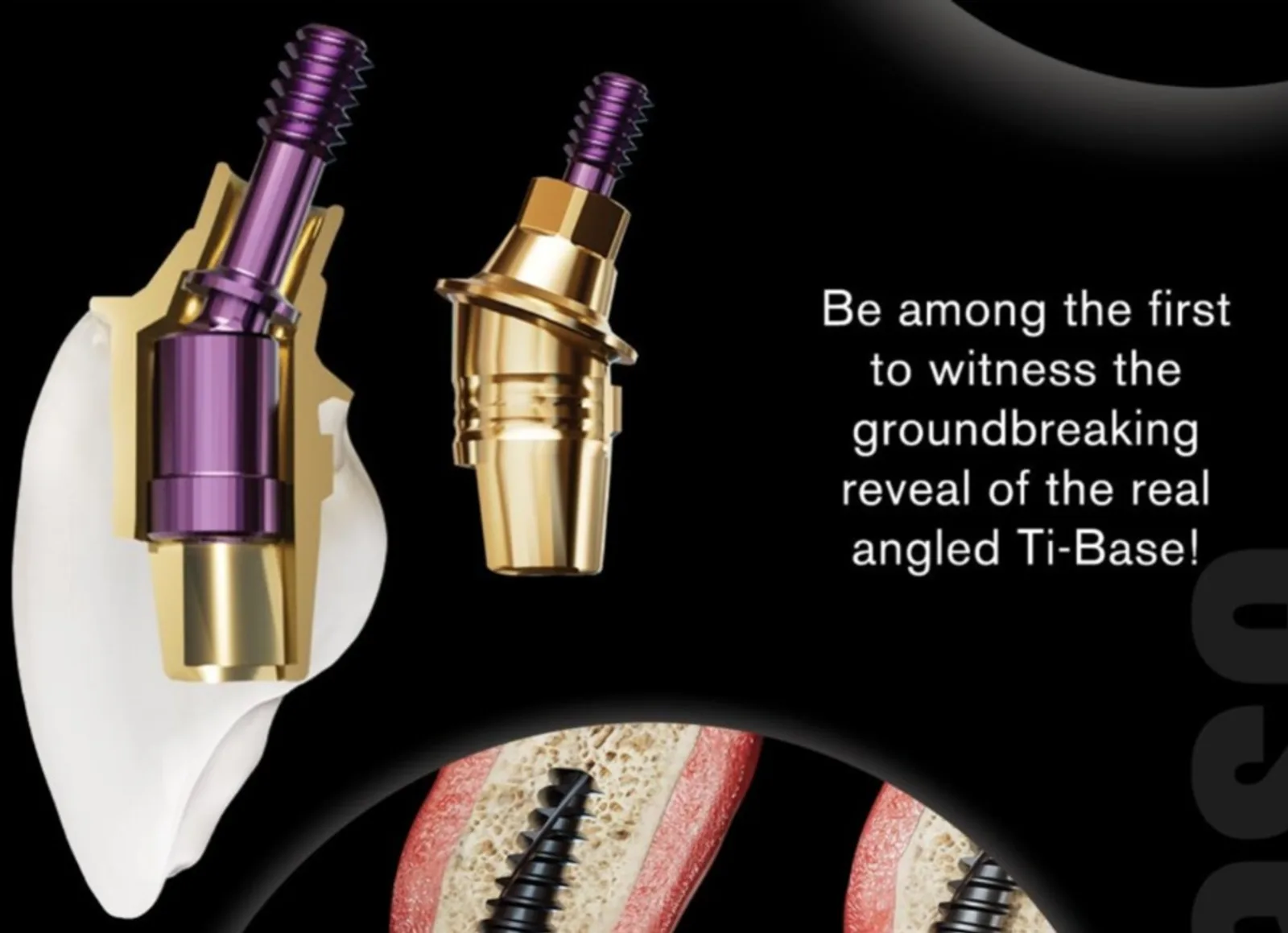 Implant Crown — Lateral photo 5