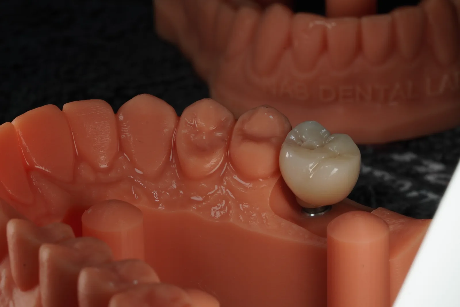 Implant Crown — Molar photo 4
