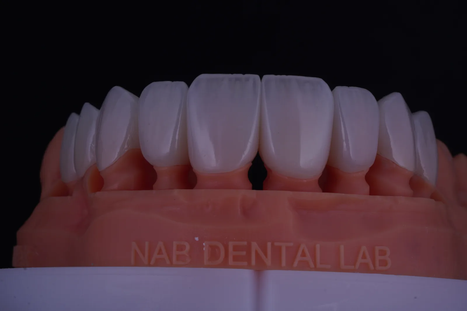 Modern Veneer — Case 1 photo 2