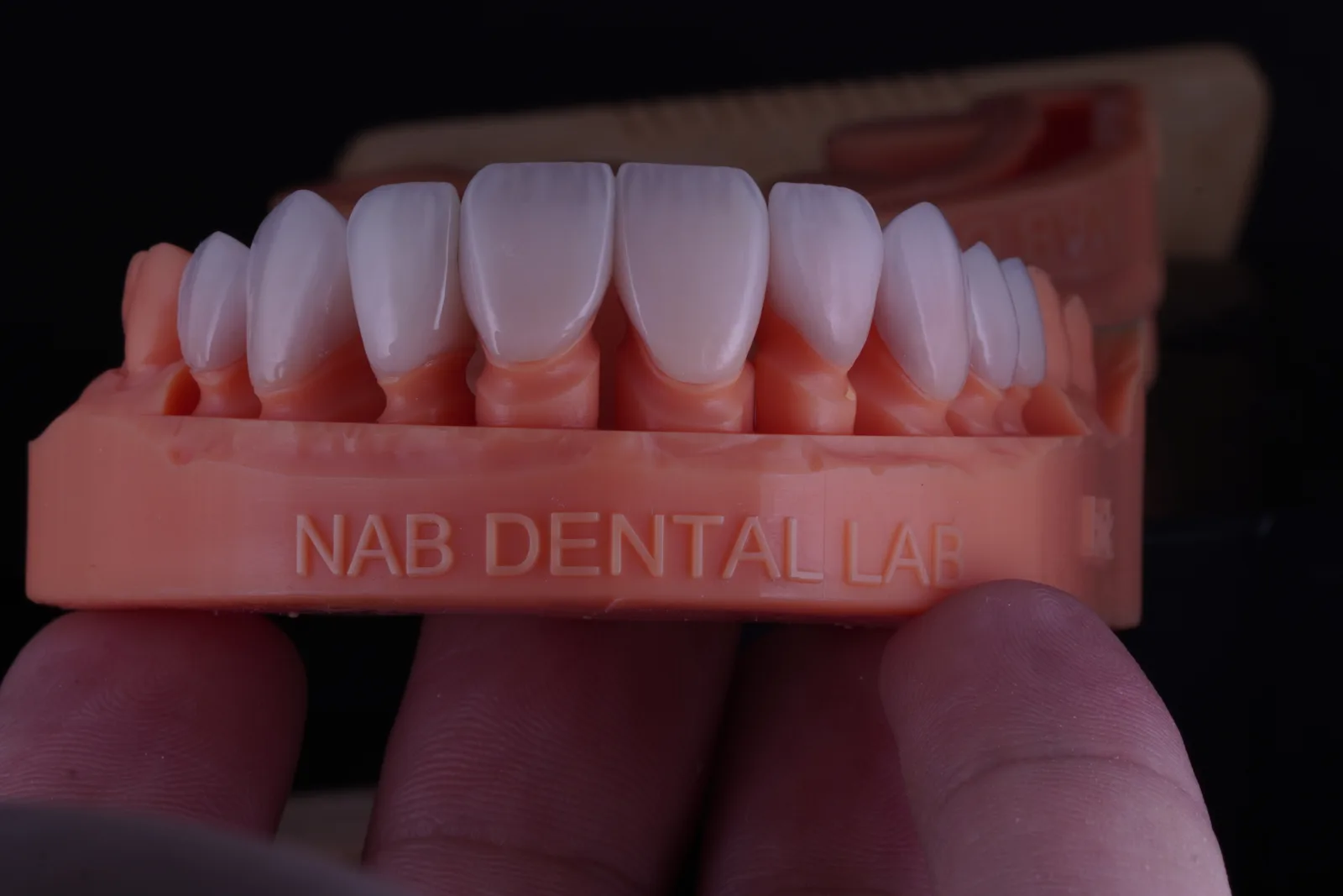Modern Veneer — Case 3 photo 4